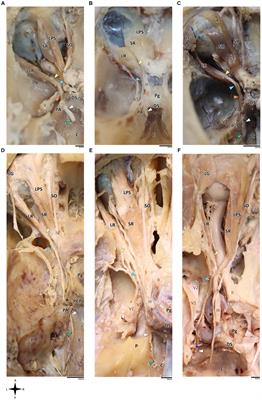 Unveiling the vulnerability of the human abducens nerve: insights from comparative cranial base anatomy in mammals and primates